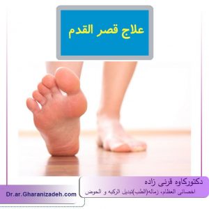 علاج قصر القدم