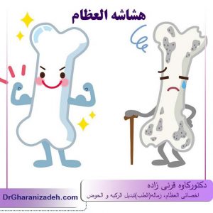 هشاشه العظام