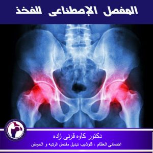 أنواع الكسور حول الورك و الفخذ