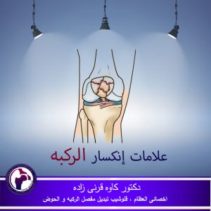 كسر الركبه