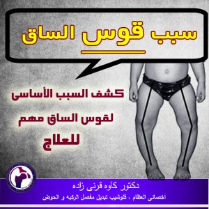 ساق المقوسه