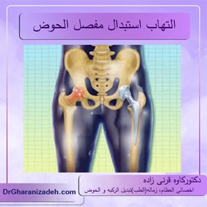 التهاب استبدال مفصل الحوض