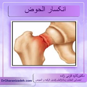 انکسار-الحوض-1