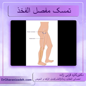 تمسک-مفصل-الفخذ