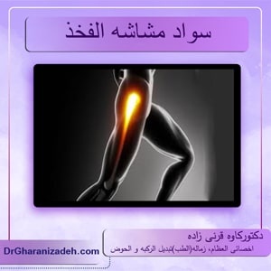 سواد-مشاشه-الفخذ