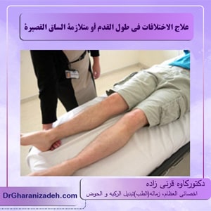 علاج الاختلافات في طول القدم أو متلازمة الساق القصيرة      