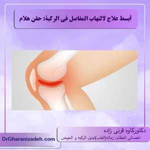 أبسط علاج لالتهاب المفاصل في الركبة: حقن هلام