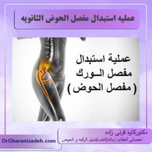 عملیه استبدال مفصل الحوض الثانویه                 