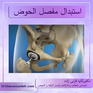 استبدال مفصل الحوض